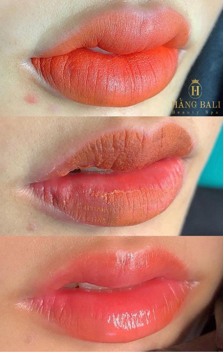 Hình ảnh thực tế về quy trình phun môi chuẩn y khoa tại Hằng Bali Beauty Spa