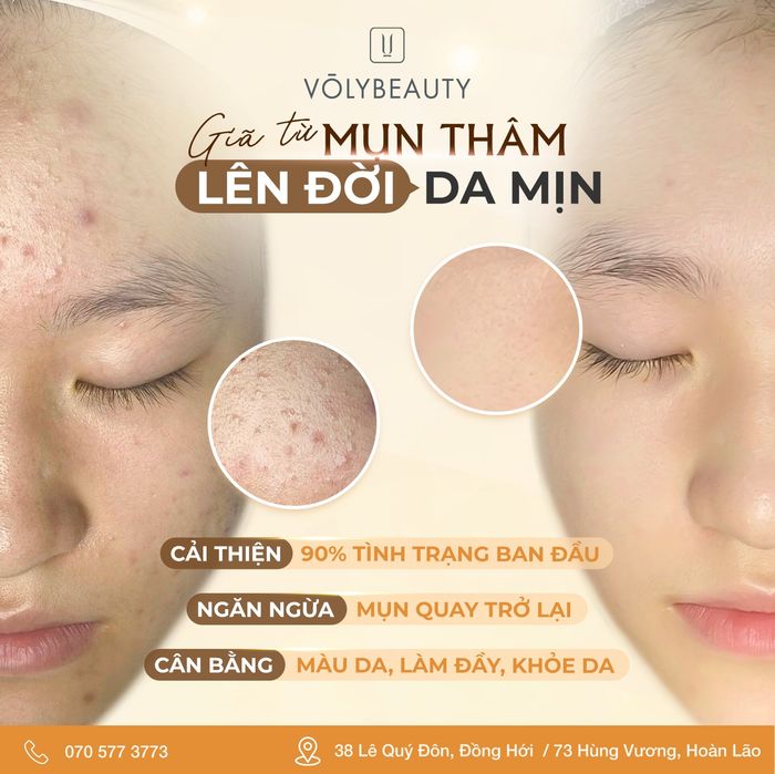 Hình ảnh liệu trình làm đẹp tại Võ Ly Beauty Spa