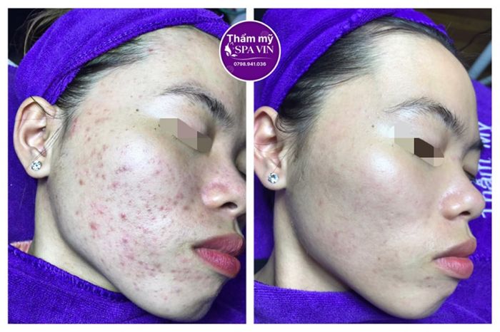 Hình ảnh của Spa Vin Đà Lạt