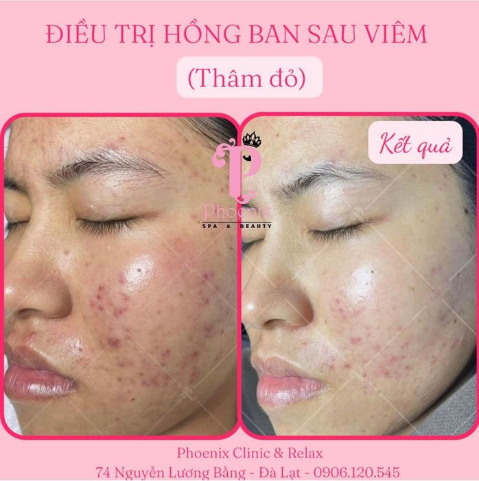 Hình ảnh tại Phoenix Spa & Academy