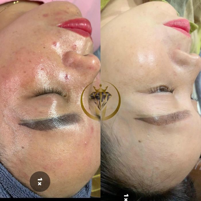 Diamond Spa & Beauty - Hình ảnh 2