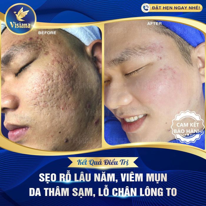 Hình ảnh thứ hai tại Thẩm mỹ viện quốc tế Visiana by Lê Uyên
