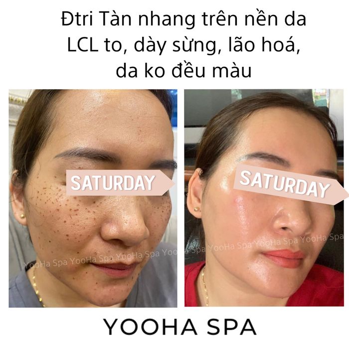 Hình ảnh liệu trình chăm sóc da tại YooHa Beauty Spa