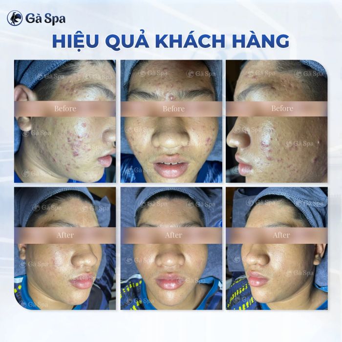 Gà Spa Bến Tre - Hình ảnh 2