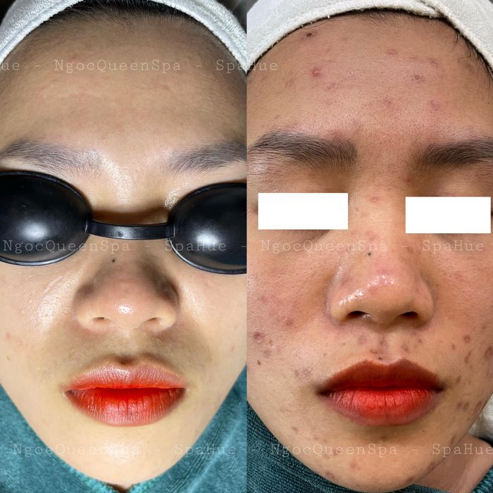 Khu vực điều trị chuyên nghiệp tại Ngoc Queen Spa