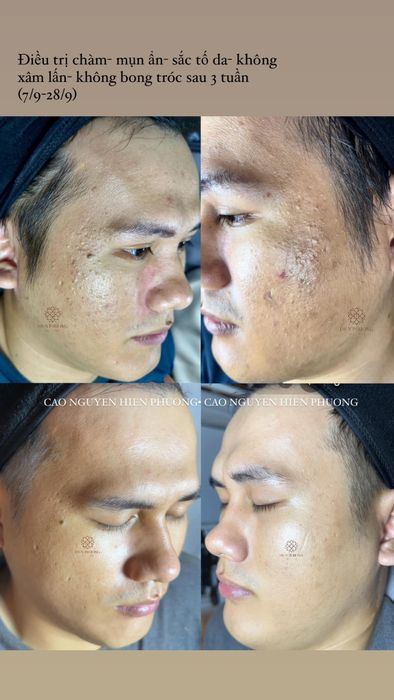 Không gian thư giãn tại Hiền Phương Spa