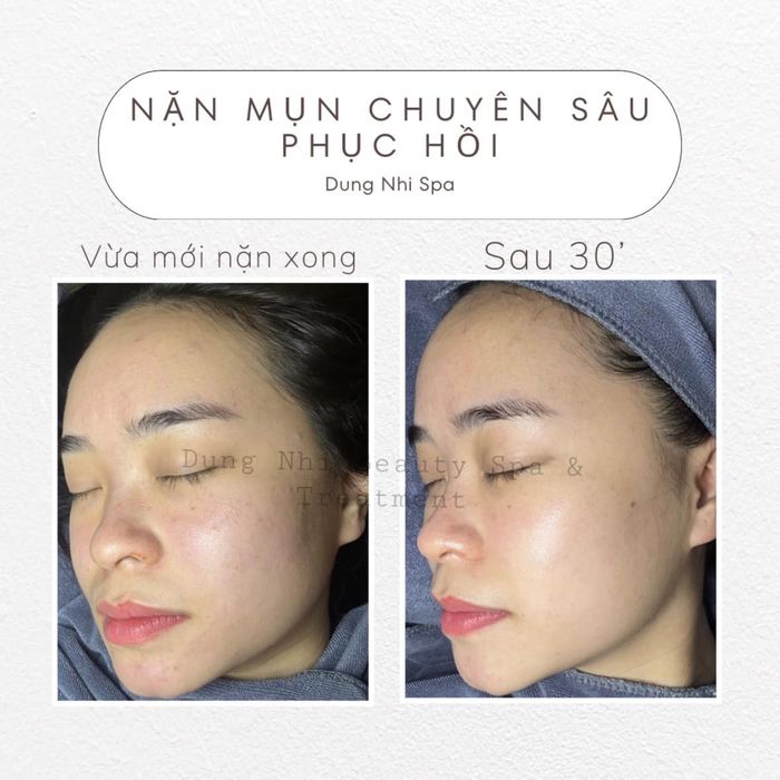 Hình ảnh tại Dung Nhi Beauty Spa