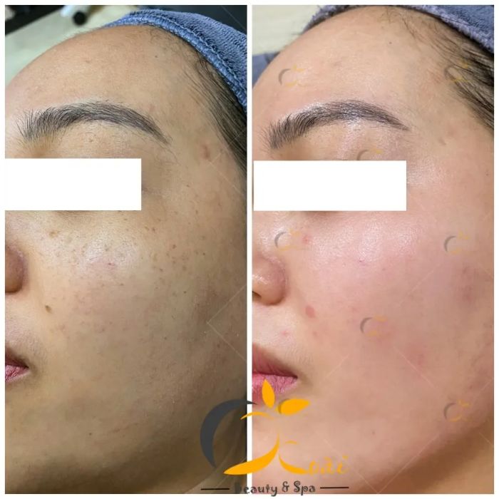 Xoài Beauty & Spa hình ảnh 1