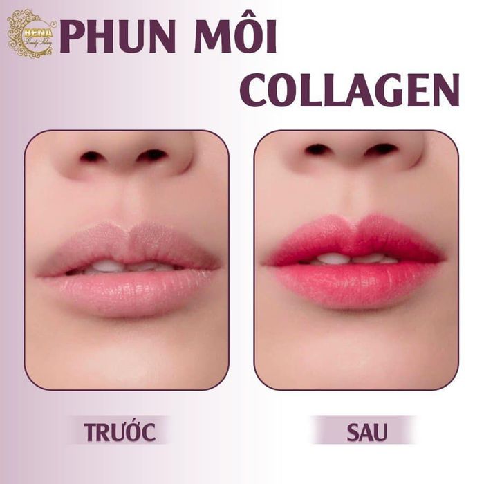 Không gian sang trọng đẳng cấp tại Thẩm Mỹ Viện BENA USA