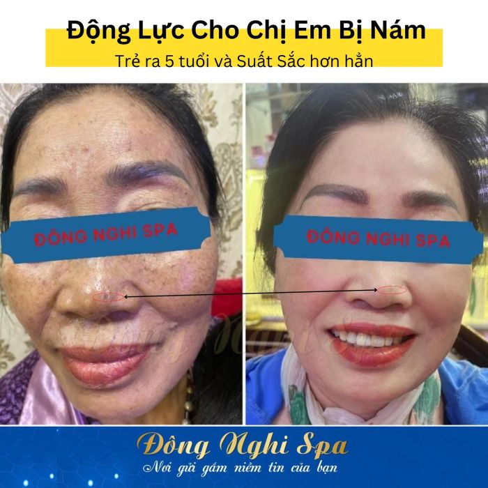 Spa Đông Nghi hình ảnh 2