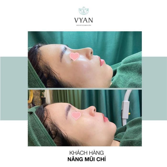 Hình ảnh quy trình điều trị da chuyên sâu tại Viện Thẩm Mỹ Vy An