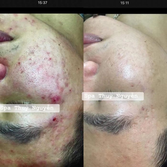 Giang Beauty Spa hình ảnh 2