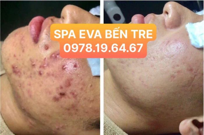 Mỹ Tiên Spa Bến Tre - Hình ảnh 2