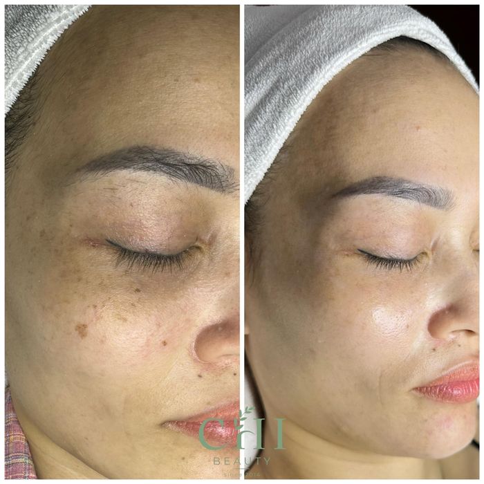 Không gian sang trọng tại Chi Skin Clinic Spa
