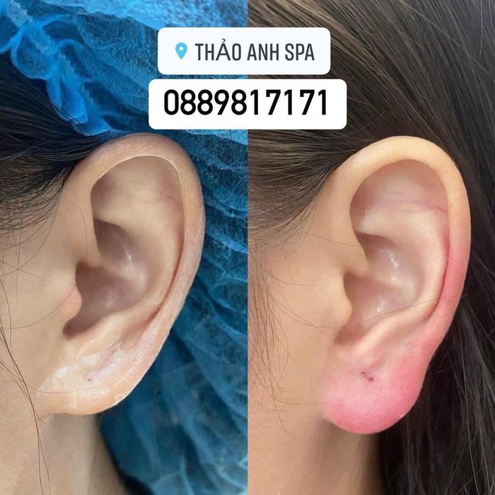 Không gian sang trọng tại Thảo Anh Spa