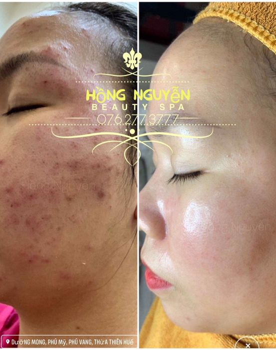Khu vực thư giãn sang trọng tại Hồng Nguyễn Spa