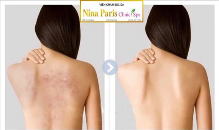Nina Paris Spa ảnh 1
