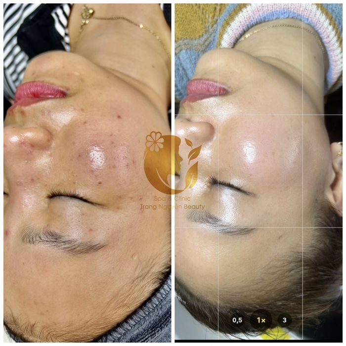 Không gian sang trọng và chuyên nghiệp tại Trang Nguyễn Beauty