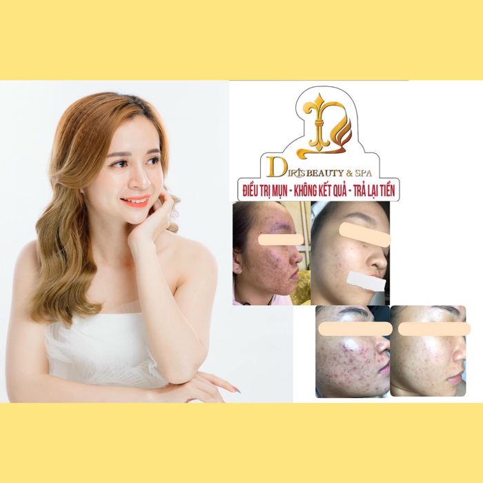 Hình ảnh quy trình điều trị da chuyên nghiệp tại Diris Beauty Spa