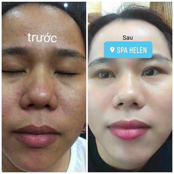 Trải nghiệm trị liệu da chuyên sâu tại Spa Helen
