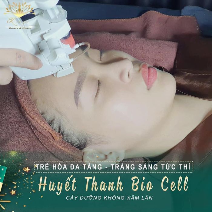 Kim Spa ảnh 1