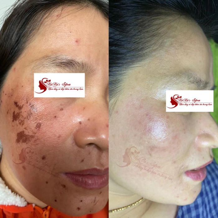 Hình ảnh ViVi's Spa 2
