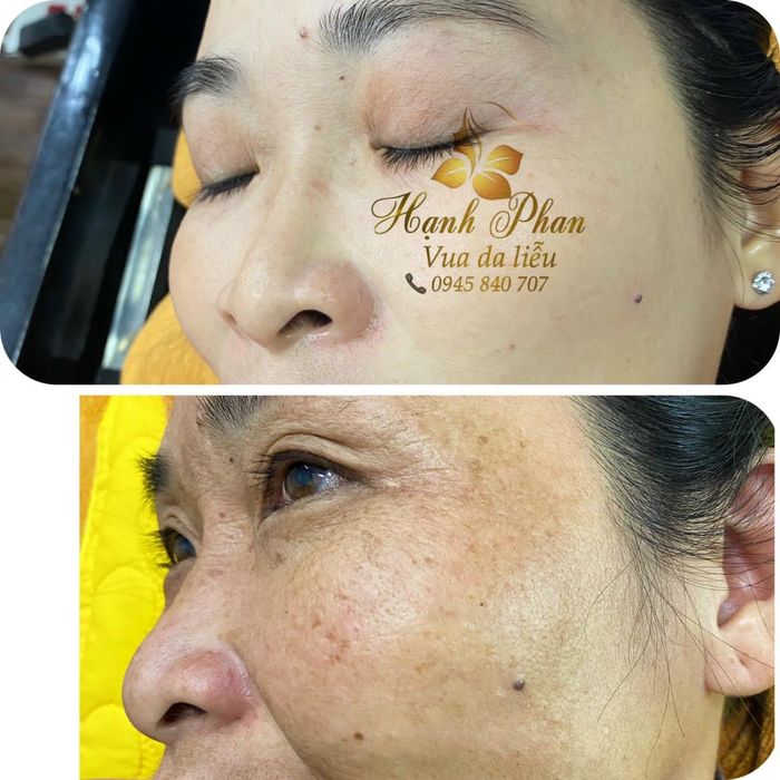 Không gian sang trọng và hiện đại tại Hạnh Phan Beauty & Clinic
