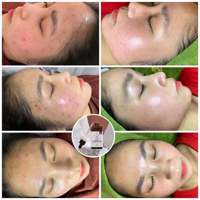 Nấm Beauty - Khoảnh khắc tỏa sáng được lưu giữ qua ống kính nghệ thuật