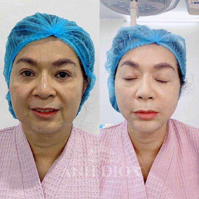 Ảnh minh họa của AnhDior Beauty