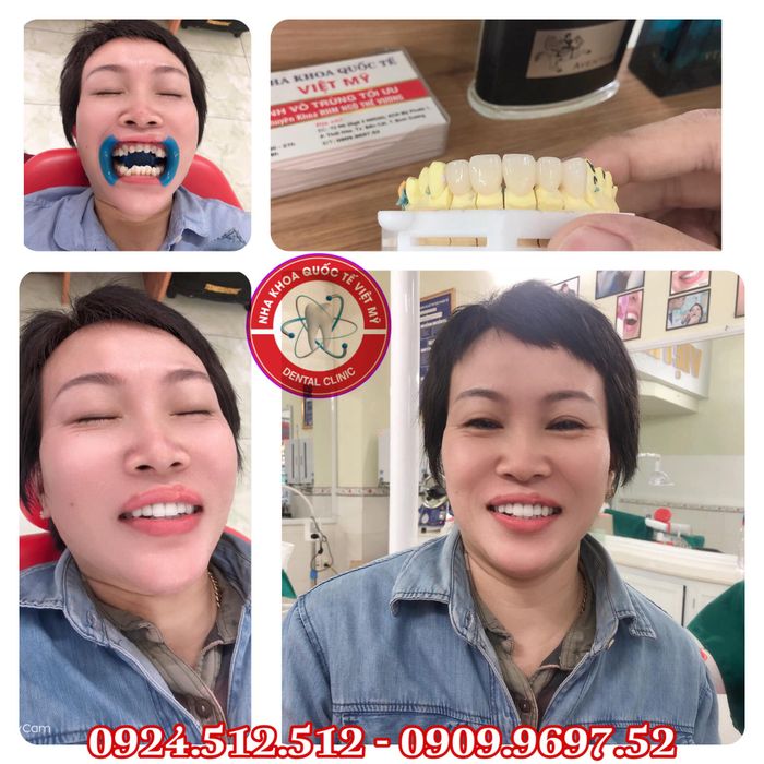 Hình ảnh đội ngũ bác sĩ chuyên nghiệp tại Nha Khoa Quốc Tế Việt Mỹ