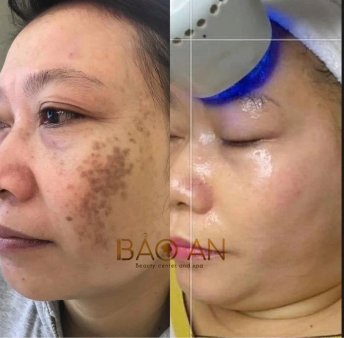 Thẩm mỹ Bảo An - Khoảnh khắc tỏa sáng được lưu giữ qua ống kính nghệ thuật