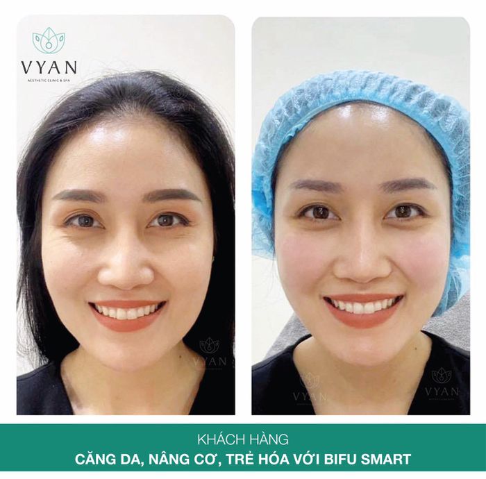 Ảnh minh họa của Vy An Spa