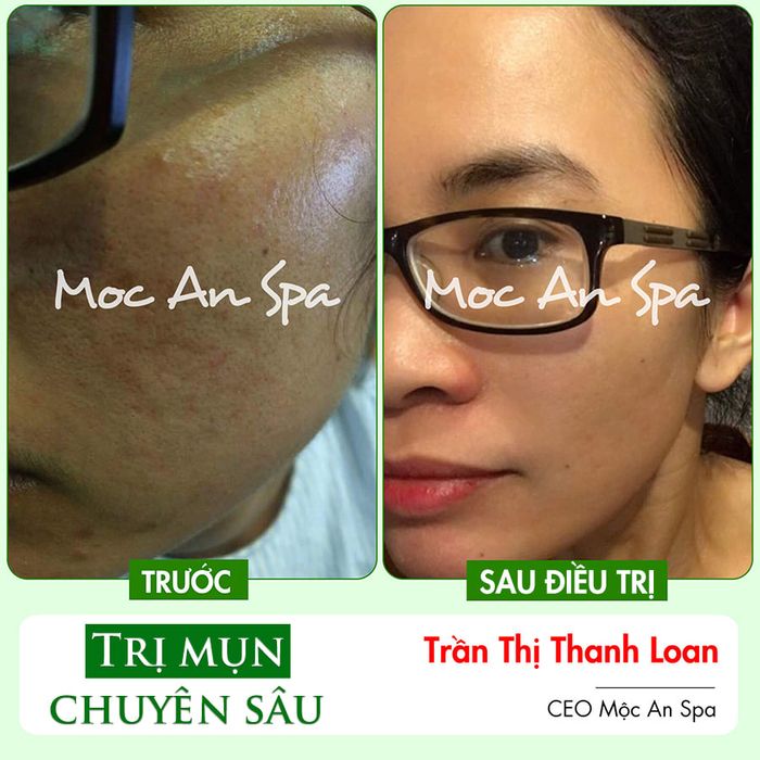 Ảnh Mộc An Spa 2