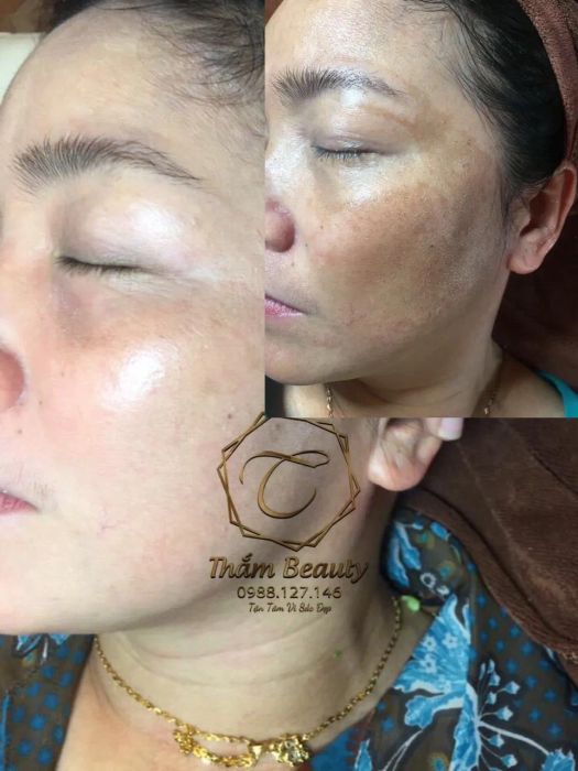 THẮM Beauty Clinic ảnh 2