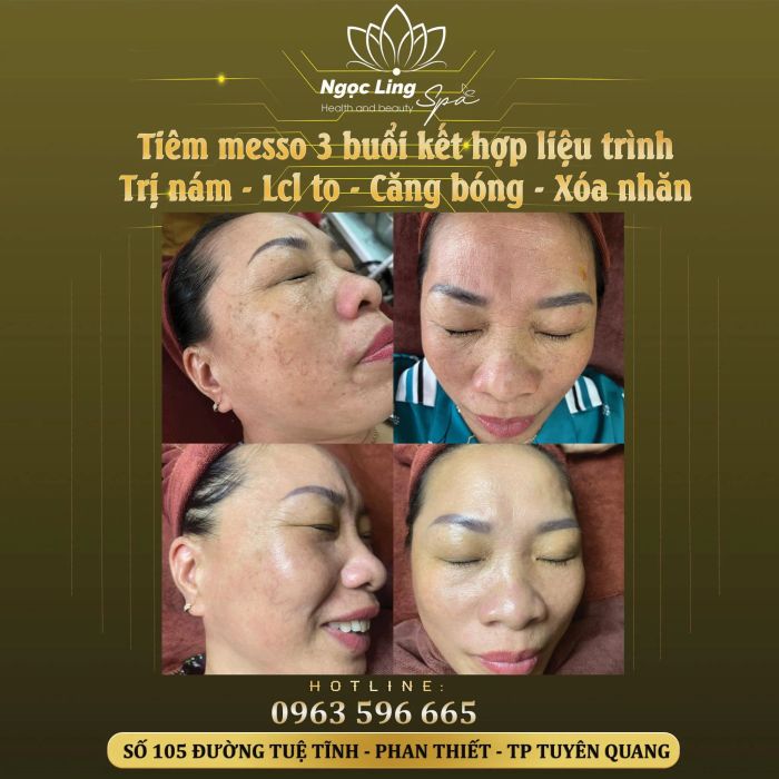 Khám phá Ngọc Linh Spa qua góc nhìn nghệ thuật - nơi mỗi khoảnh khắc đều là trải nghiệm thư giãn tuyệt vời.