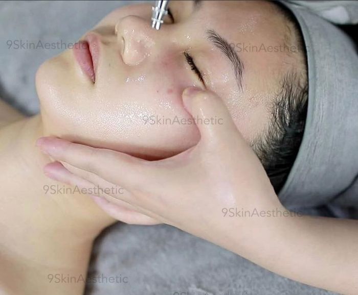 Ảnh minh họa của 9Skin Spa