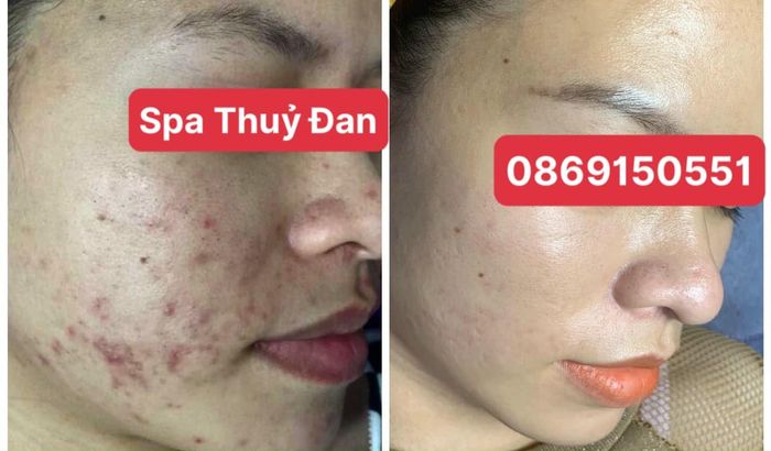 Quy trình chăm sóc da chuyên nghiệp tại Thuỷ Đan Spa