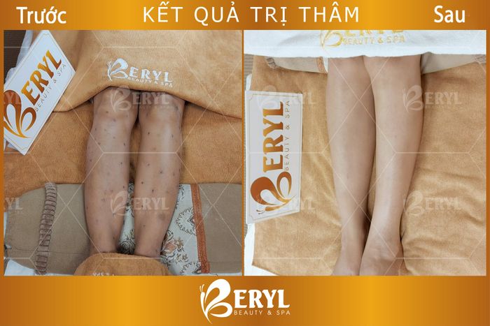 Beryl Beauty & Spa ảnh 2