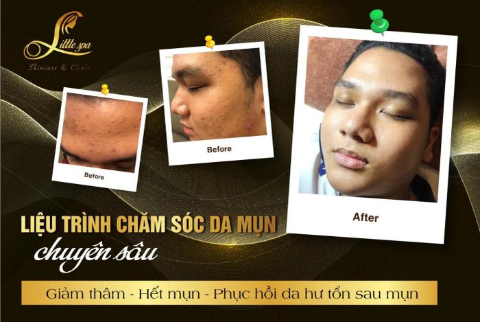 Little Spa & Clinic ảnh 2