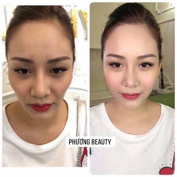 Phương Phương Beauty Clinic hình ảnh 2