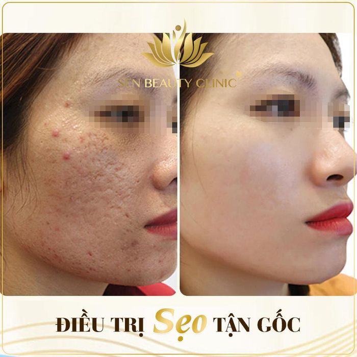 Ảnh Sen River Spa 2