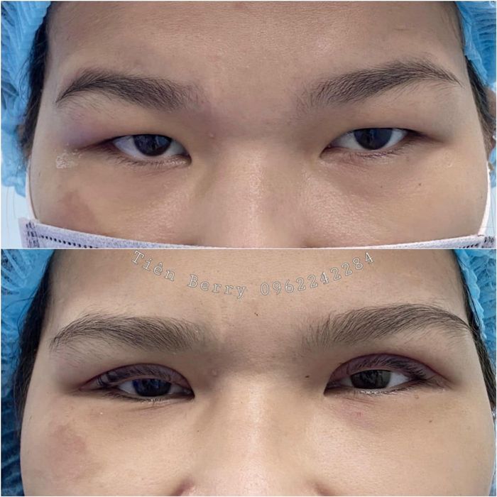 Hình ảnh không gian trị liệu cao cấp tại Tiên Berry Beauty Spa