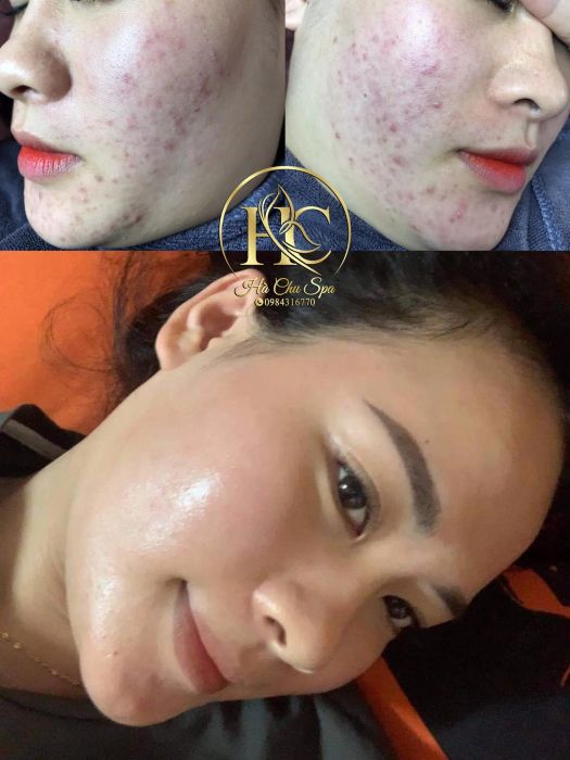 Hà Chu Spa - Hình ảnh 2