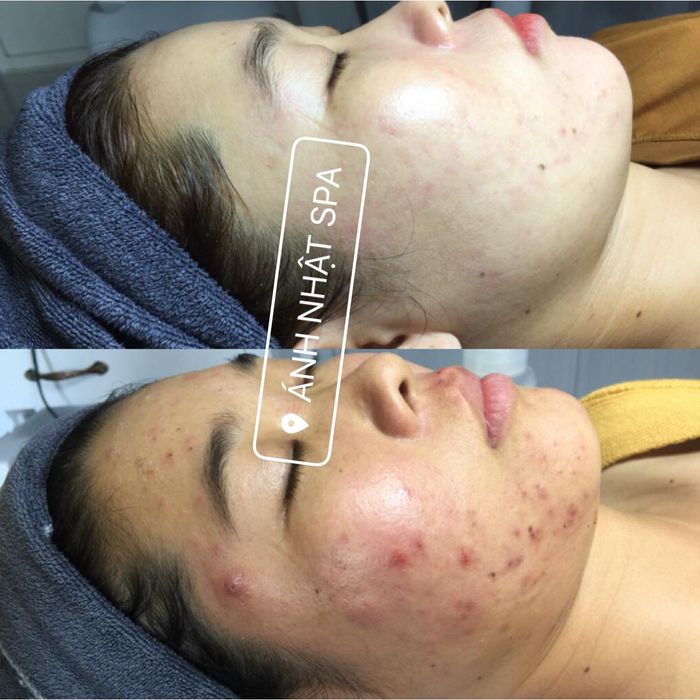 Ánh Nhật Spa - Hình ảnh 2