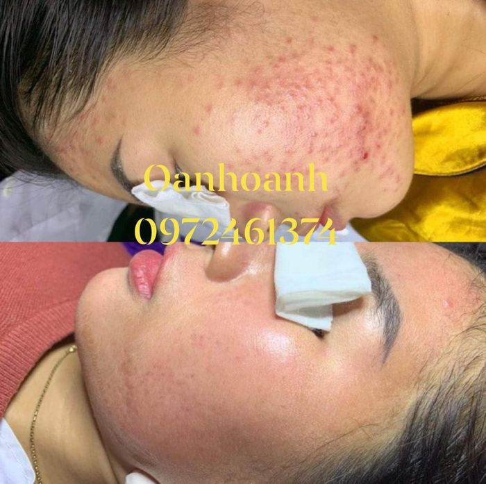 OANH Clinic & Academy hình ảnh 2