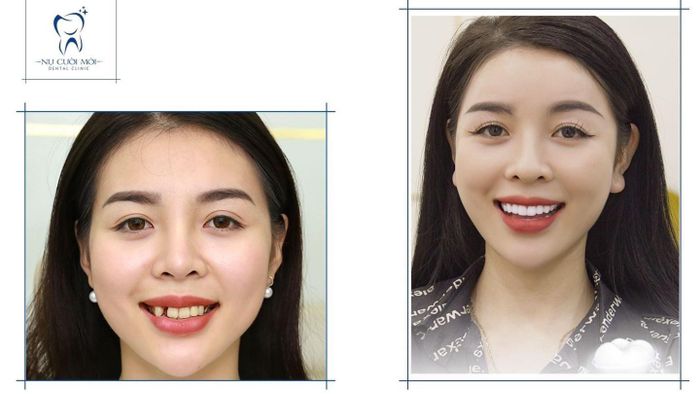 Hình ảnh không gian hiện đại tại Nha Khoa Nụ Cười Mới