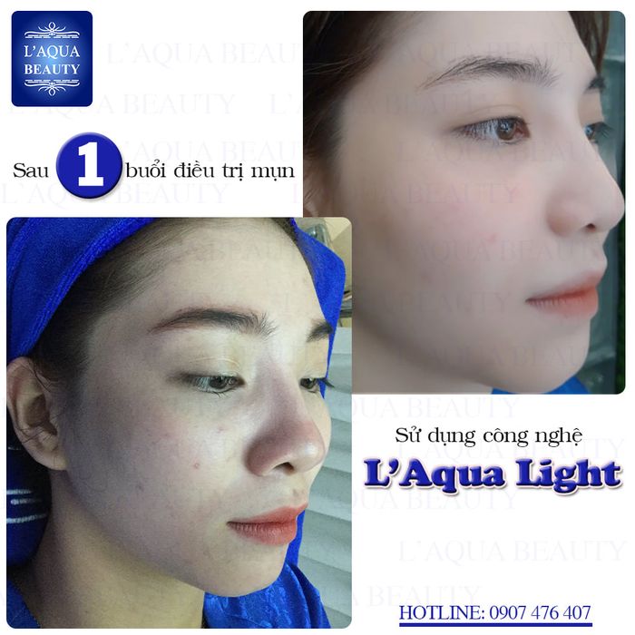 L'Aqua Beauty ảnh 1