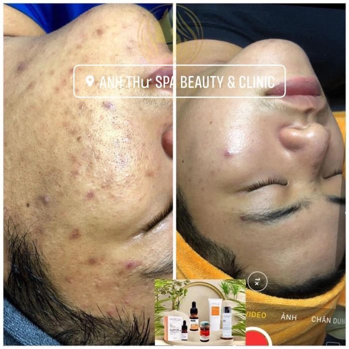 Phòng điều trị da chuyên sâu tại Anh Thư Spa