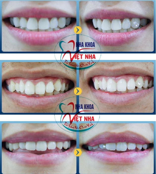 Hình ảnh đội ngũ bác sĩ chuyên môn cao tại Nha Khoa Việt Nha