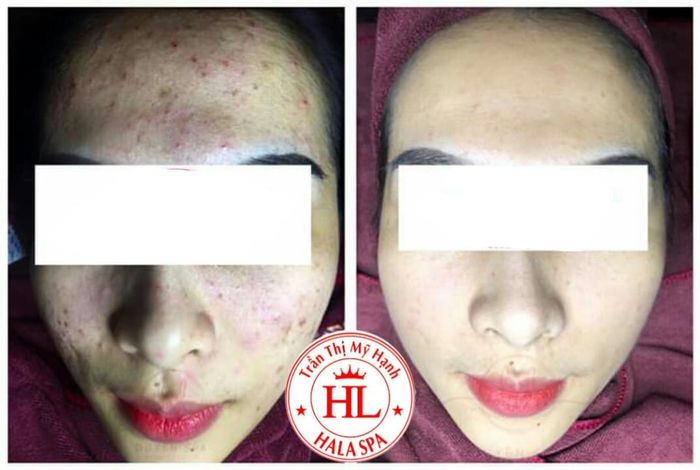HaLa Spa - Hình ảnh 1
